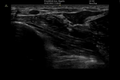 Anisotropie ausgleichen