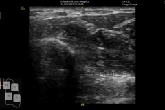 Falsches Preset, kein compund imaging