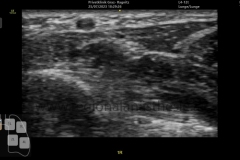 Falsches Preset, kein compund imaging