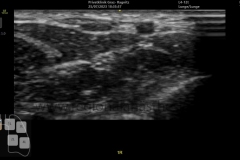 Falsches Preset, kein compund imaging